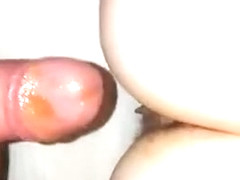 Raw anal