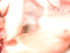 Atlases Supports Balls