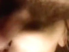 Wife getting skull drilled