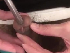 10 mm metallic ball sound inserting bladder and can't urinate